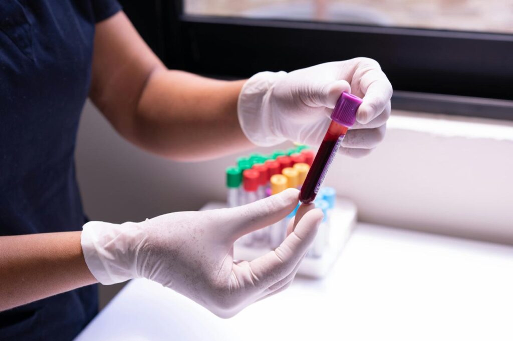 Why You Need Blood Tests Every Year