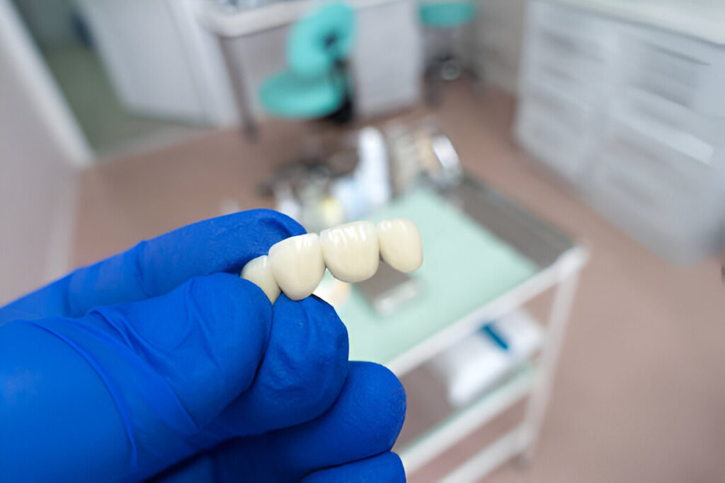 The Healing Process of Dental Implants: What To Expect