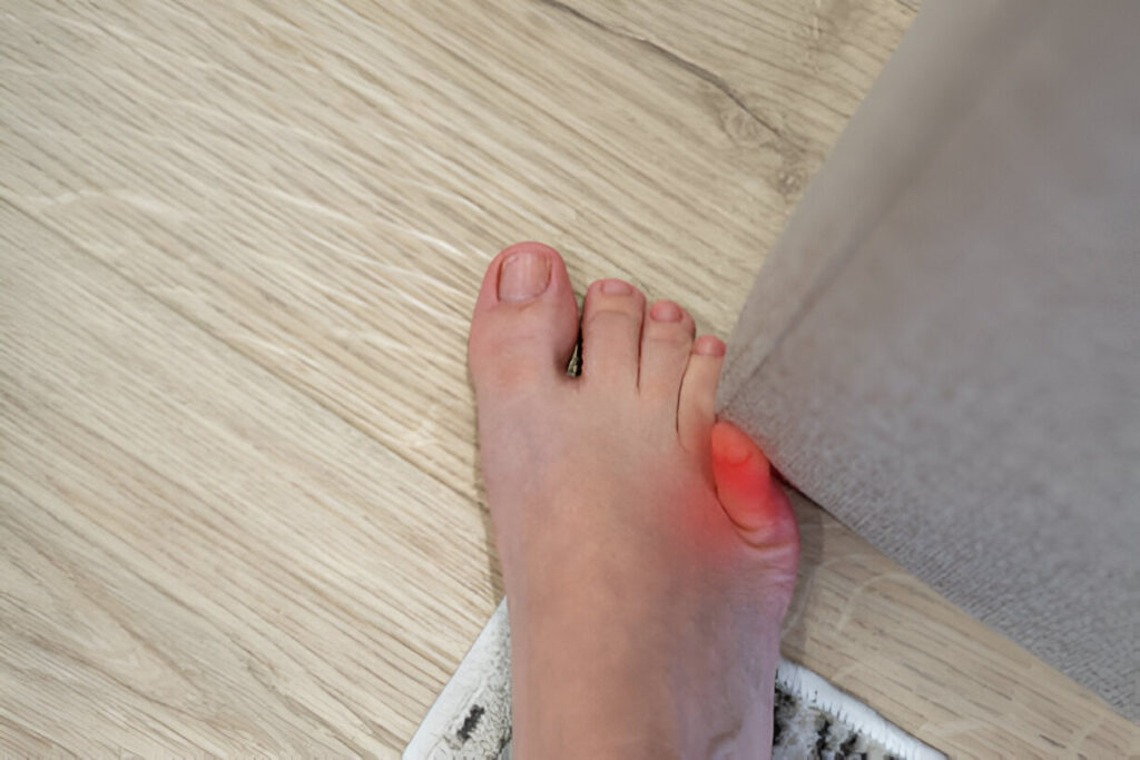 How to Handle Chronic Foot Pain